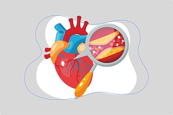 Как привести холестерин в норму: вся правда о «плохом» и «хорошем» холестерине Как привести холестерин в норму: вся правда о «плохом» и «хорошем» холестерине